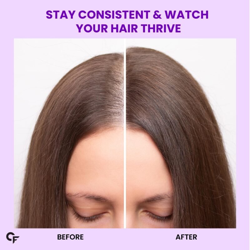 Carbamide Forte Biotin Tablets for Hair Growth with Amla, Brahmi & Bamboo Extract | Hair Growth Tablet | Hair Vitamins | Hair Supplements for Women & Men - 90 Veg Tablet - Image 7